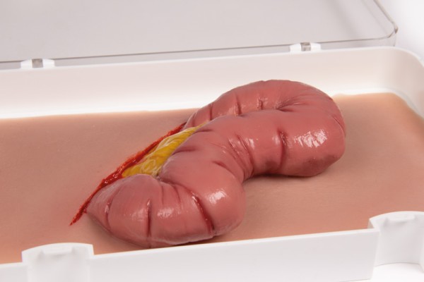 Wound moulage thick intestine exit