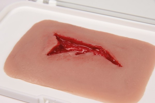 Wound moulage laceration