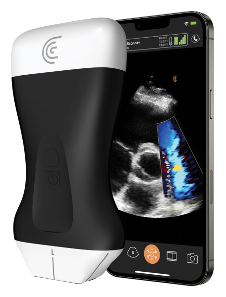 PAL HD3 Wireless Ultrasound Scanner, with 3-year Clarius membership