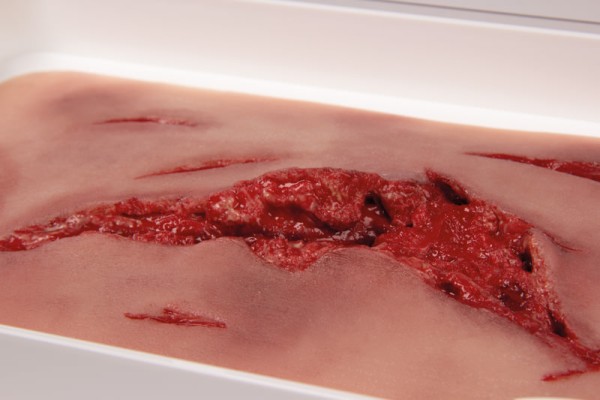 Laceration large with bleeding function